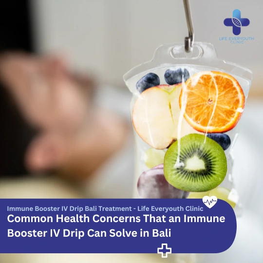 Common Health Concerns That an Immune Booster IV Drip Can Solve in Bali