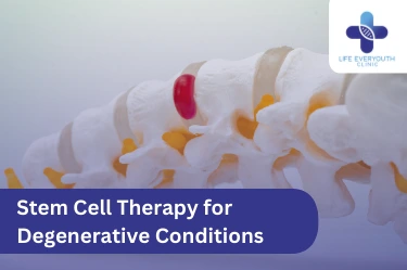 Stem Cell Therapy for Degenerative Conditions