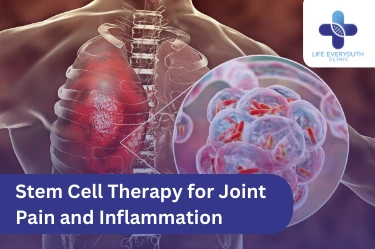 Stem Cell Therapy for Joint Pain and Inflammation