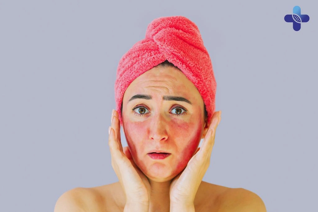 Conclusion of Understanding and Managing Prickly Heat in Bali Causes, Prevention, and Effective Treatment