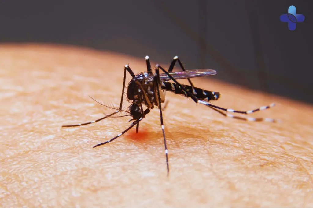 DDengue Fever in Bali: Understanding the Symptoms, Best Prevention Methods, and Effective Treatment Options for a Safe Recovery