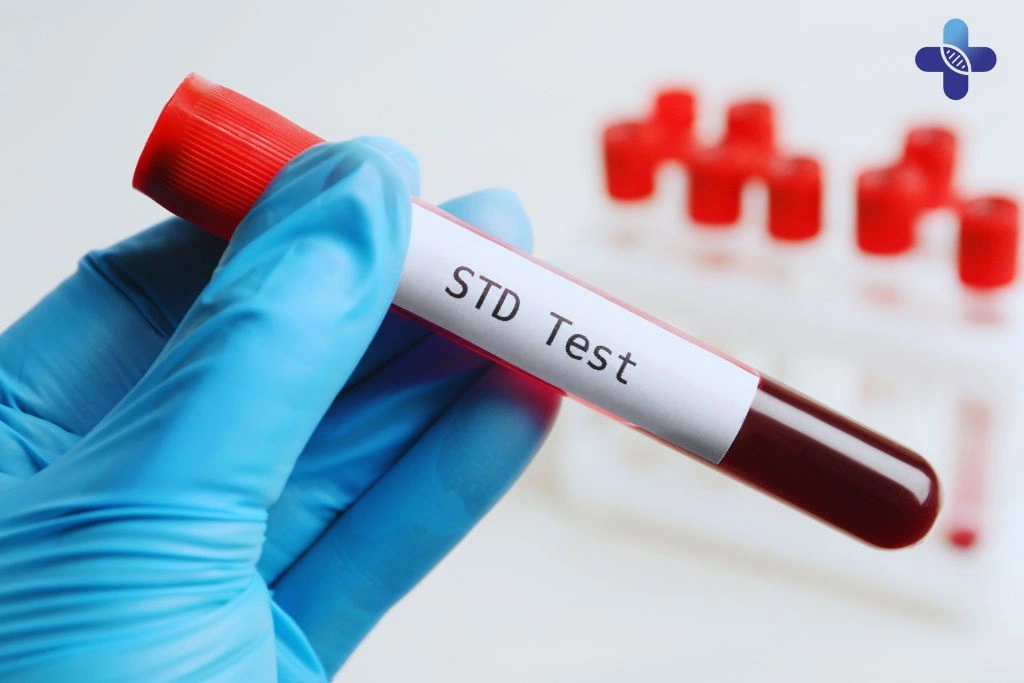 HIV Testing and Diagnosis in Bali