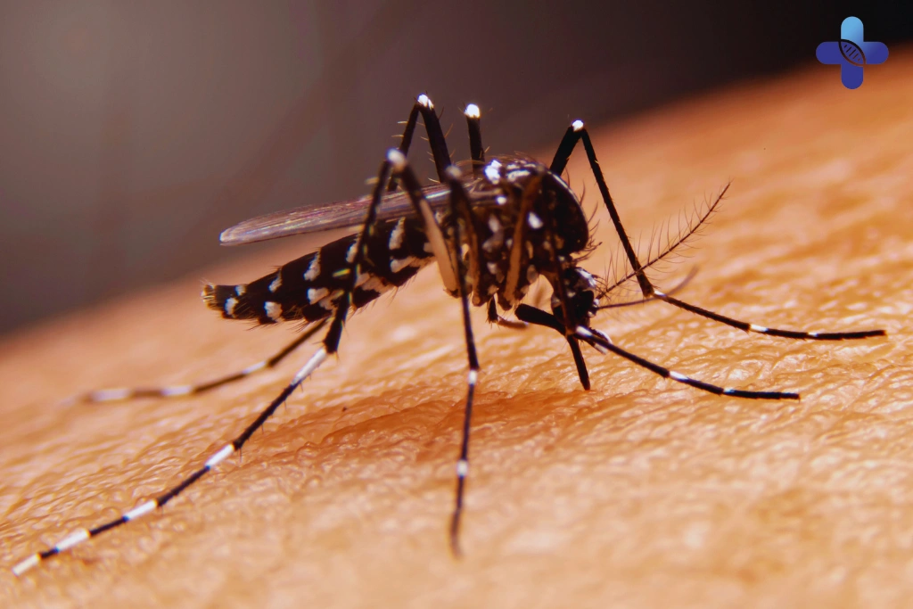 Suspect You Have Dengue Fever in Bali 7 Key Symptoms to Watch For