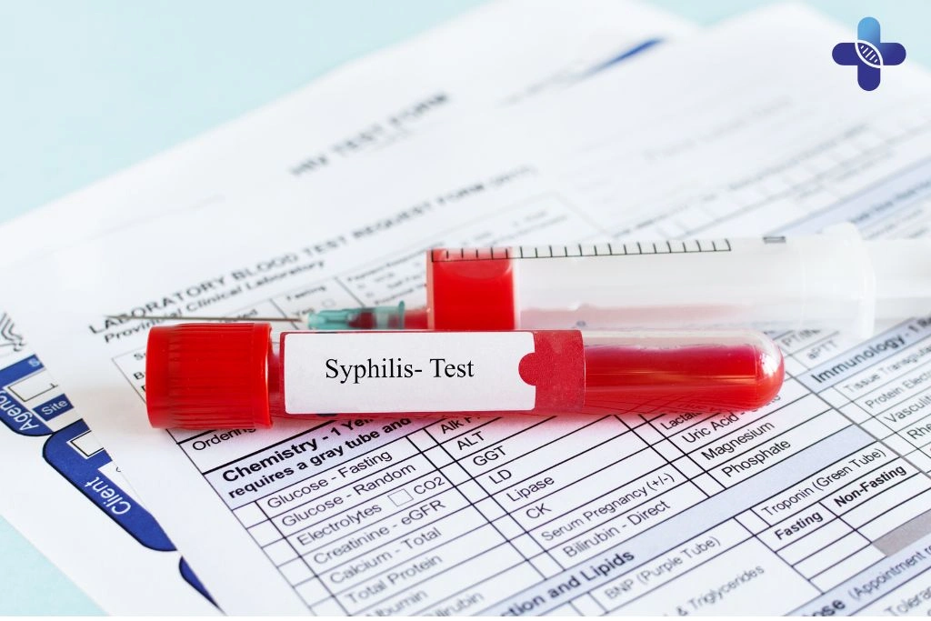 Tips How to Protect Yourself from Syphilis in Bali