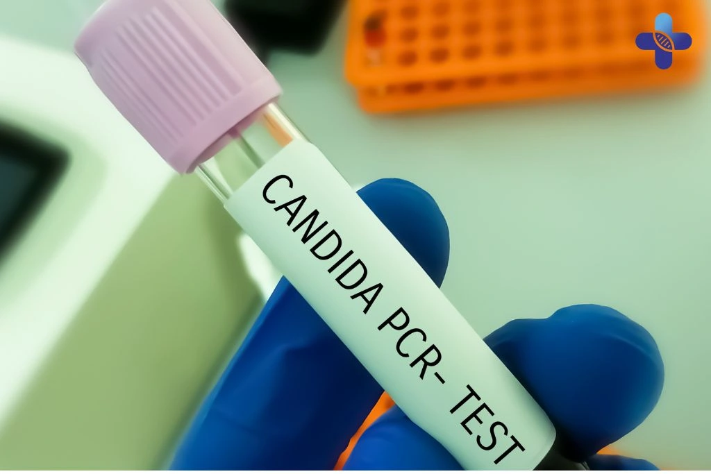 Tips for Preventing Candida Infections