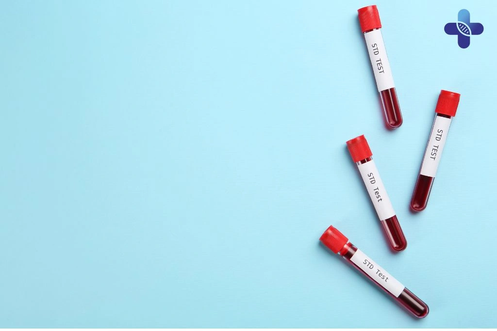 Tips to Prevent Trichomonas