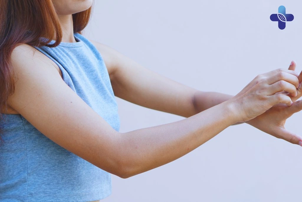 Understanding and Managing Prickly Heat in Bali Causes, Prevention, and Effective Treatment