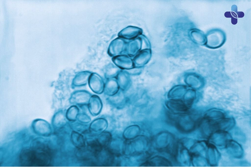 Ureaplasma Urealyticum