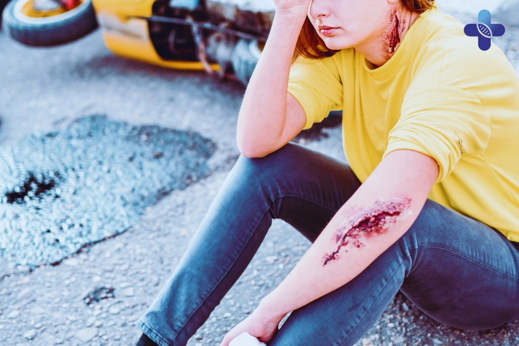 Common Injuries_ Road Rash and “Bali Kiss” Burns