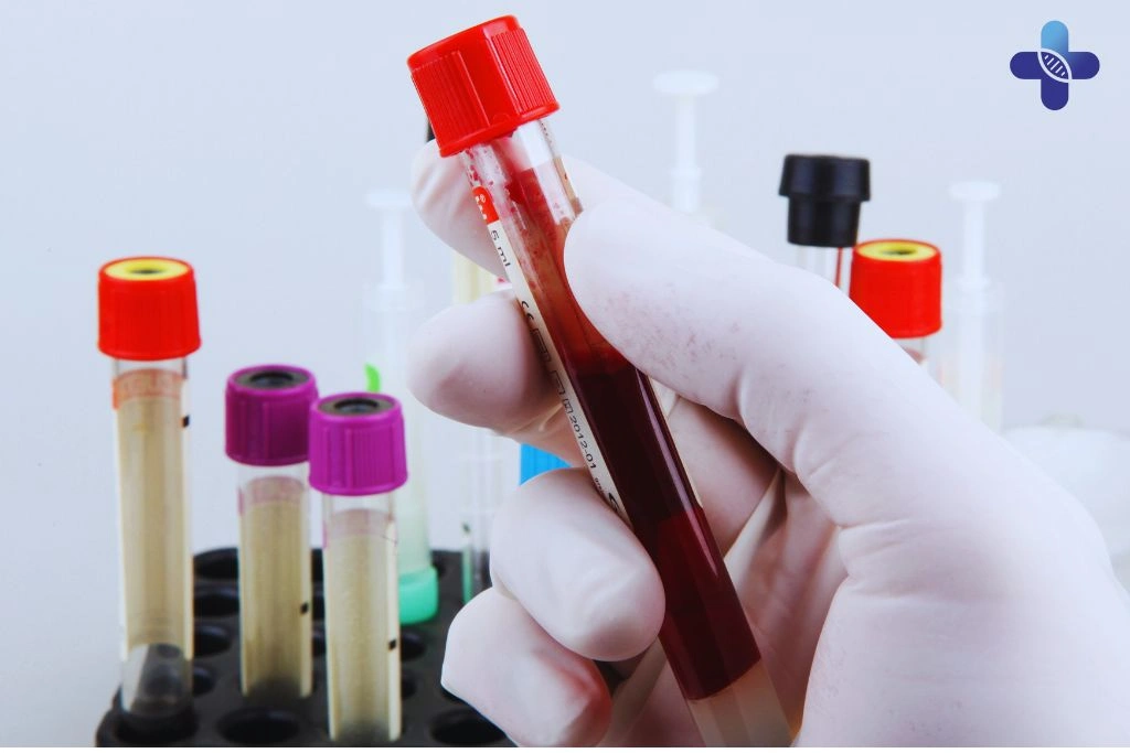 Diagnosing Neisseria Gonorrhoeae