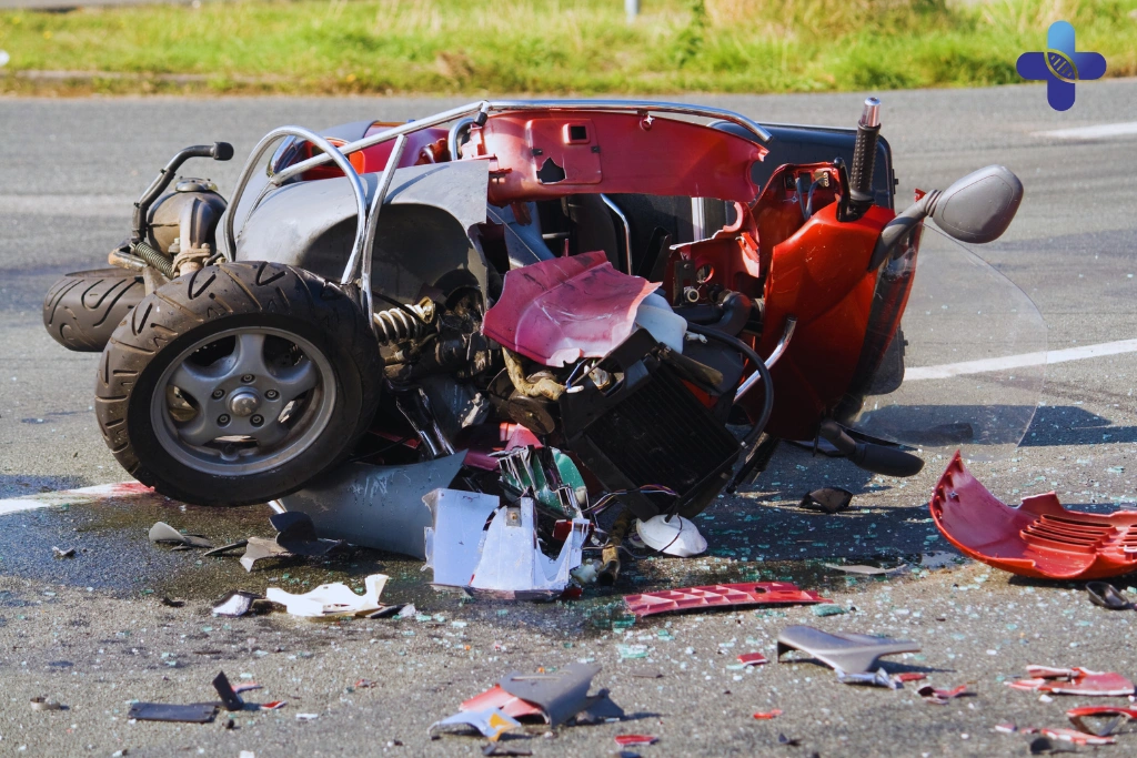 Had a Scooter Accident in Bali_ A Doctor's Step-by-Step Guide