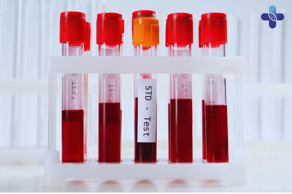 How is Mycoplasma Hominis Transmitted