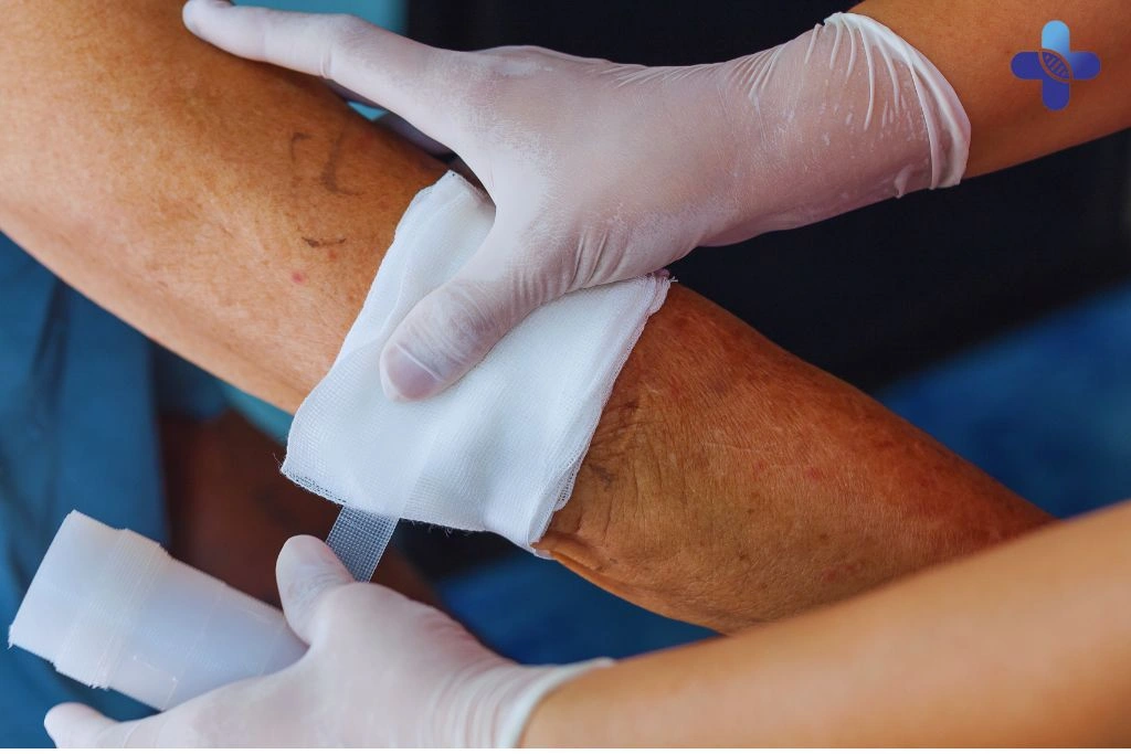 Tips for Prevention and Recovery