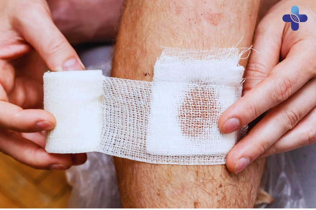Tips for Prevention and Recovery