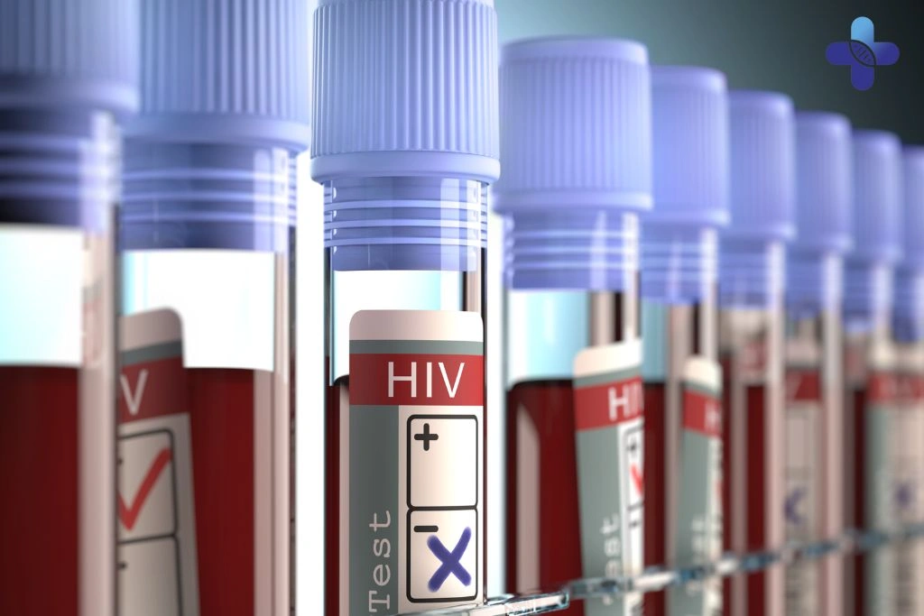 Prevention Tips How to Reduce Your Risk of AIDS in Bali