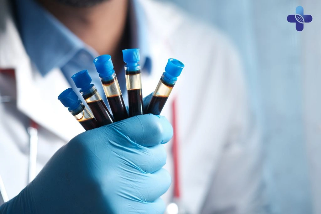 Where to Get Confidential STD Testing in Bali