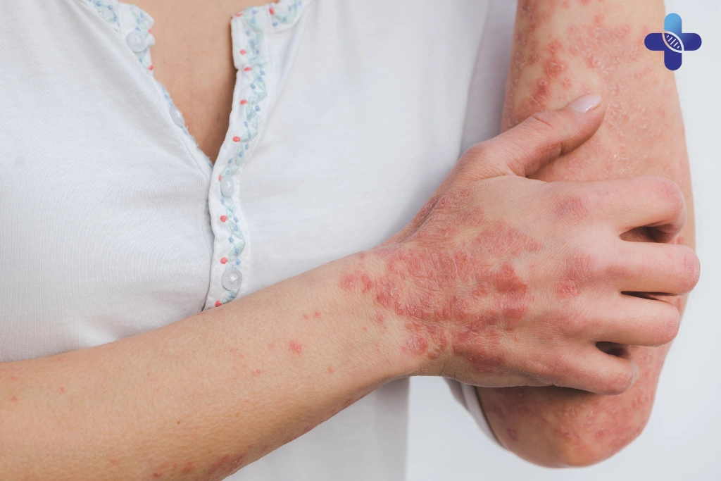 Common STDs That Begin with Skin Symptoms