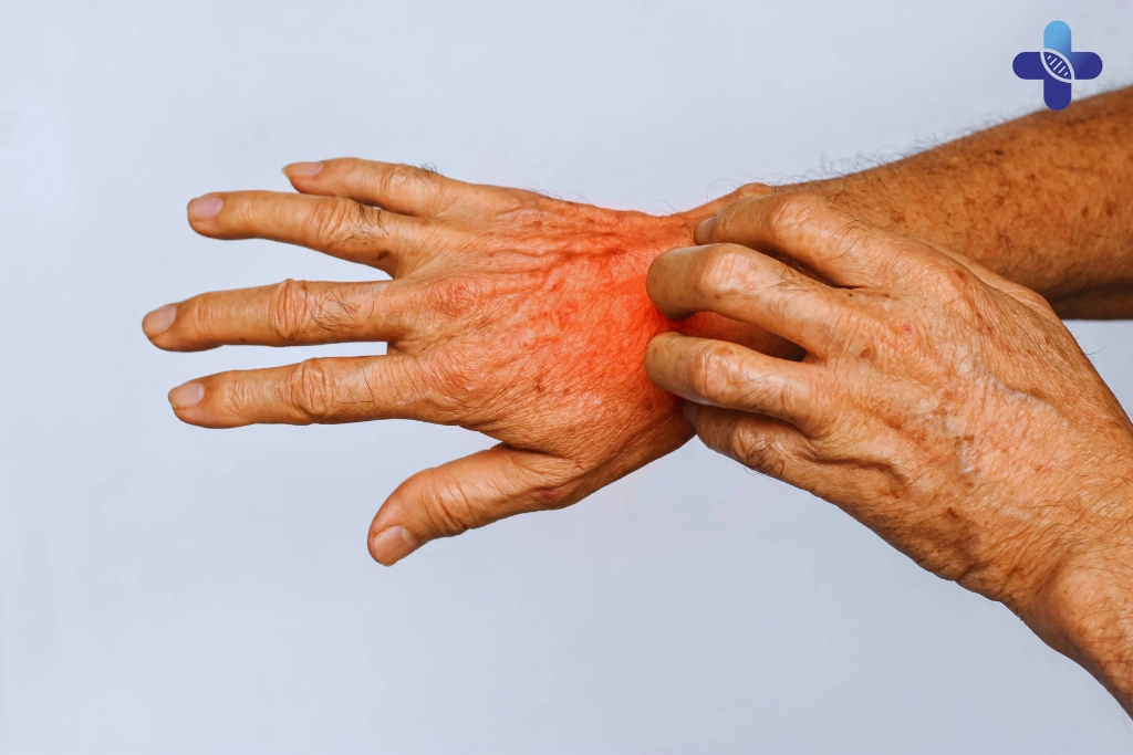 Common STDs That Start With a Rash