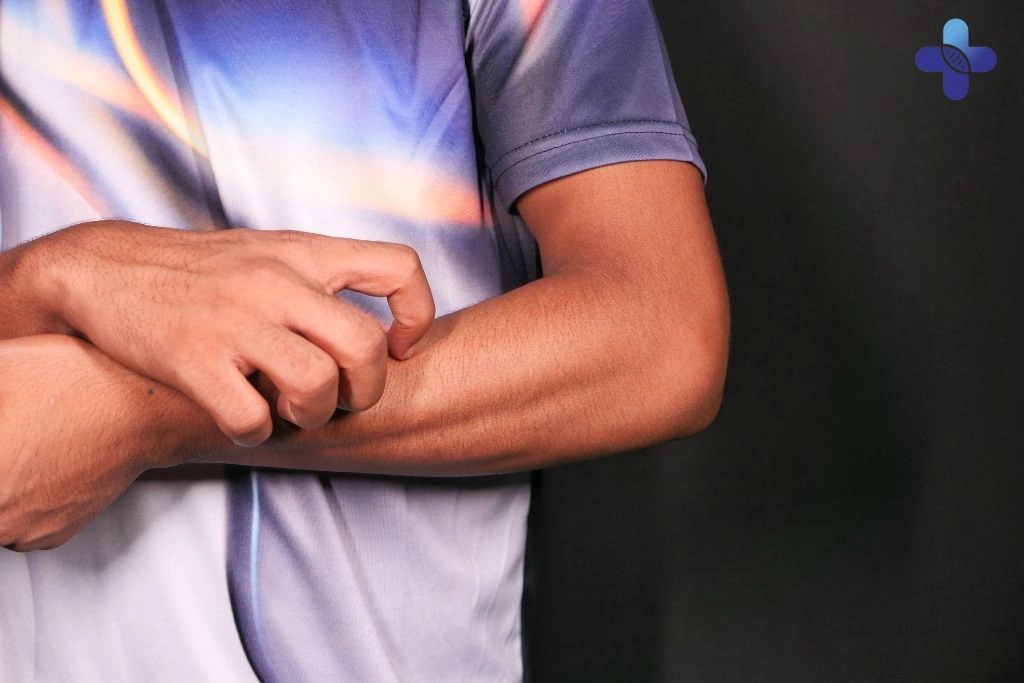Common STDs That Start With an Itch