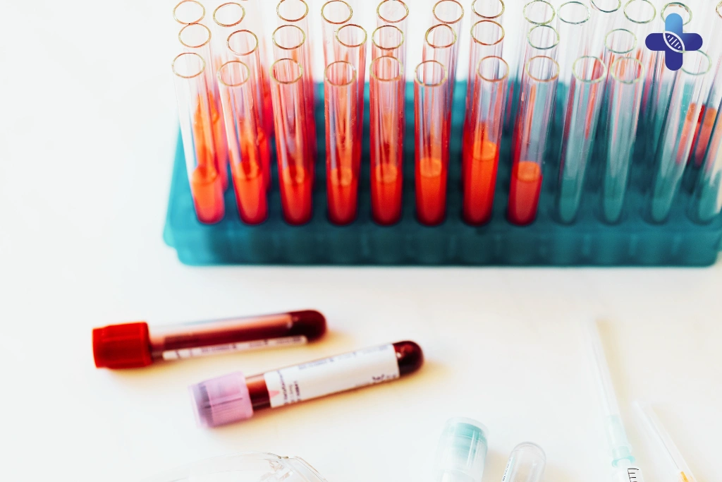 Get STD Tested Before Flying Home
