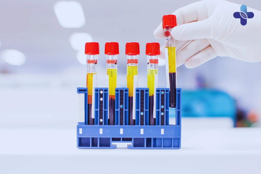 Getting Tested in Bali – Easy, Fast, and Confidential