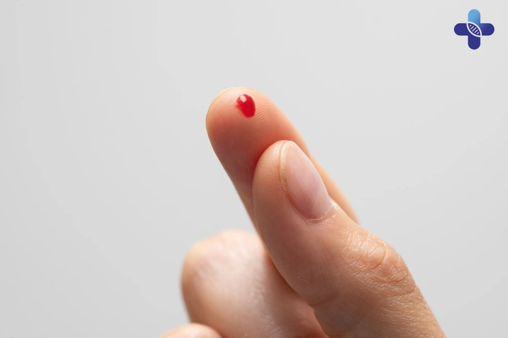 How to Tell If an STD Is Involved