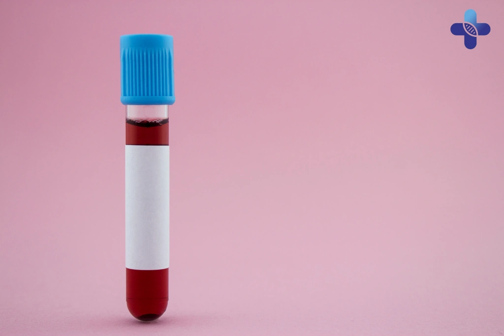 Overview of Available STD Test Packages at Life Everyouth Clinic