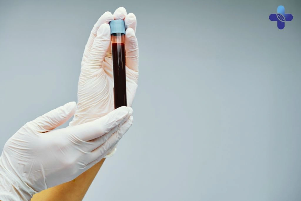 STD Testing Is Only for ‘Promiscuous’ People