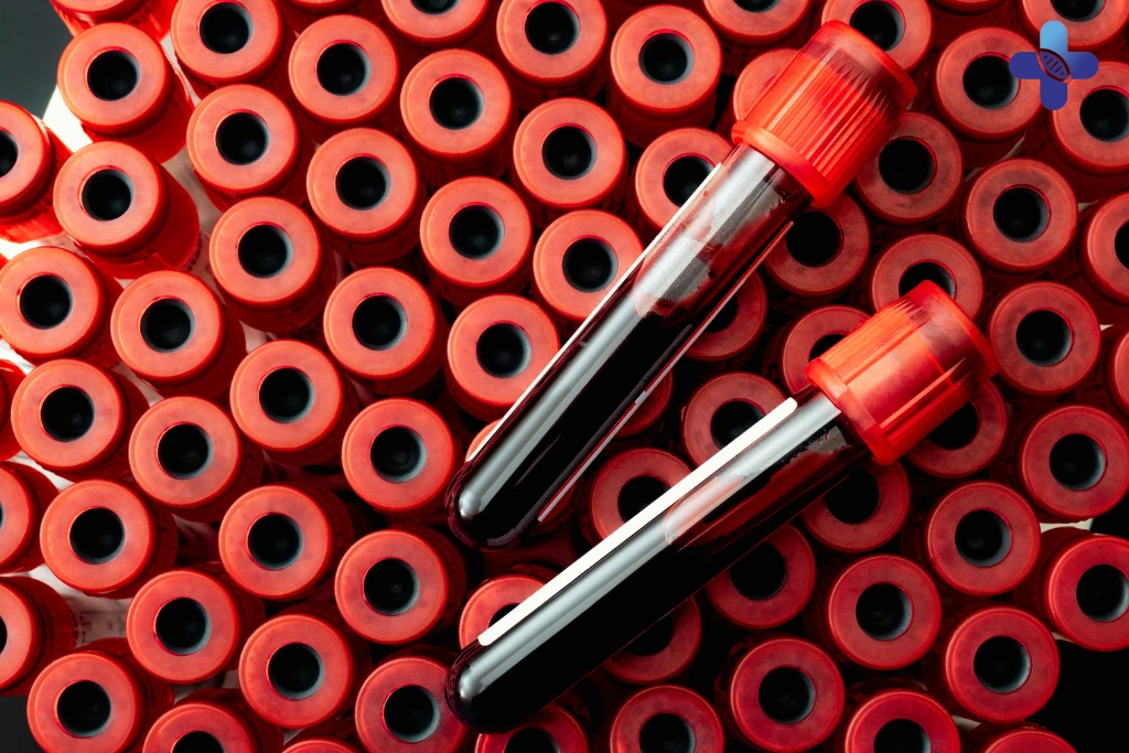 STD Testing in Bali_ A Smart Precaution