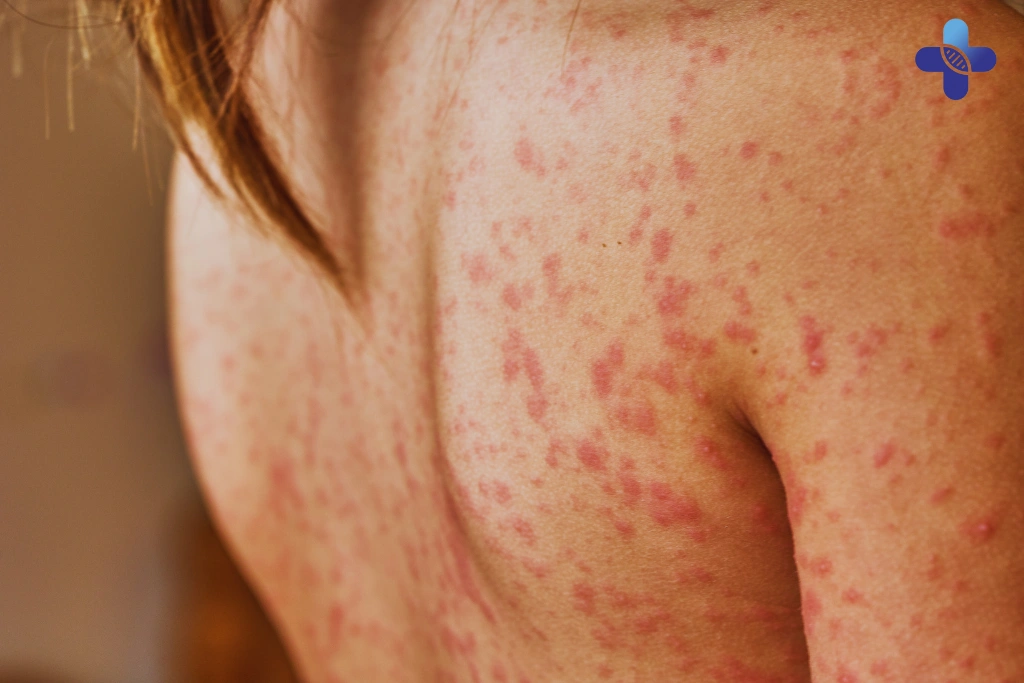 Symptoms That Are Often Misattributed