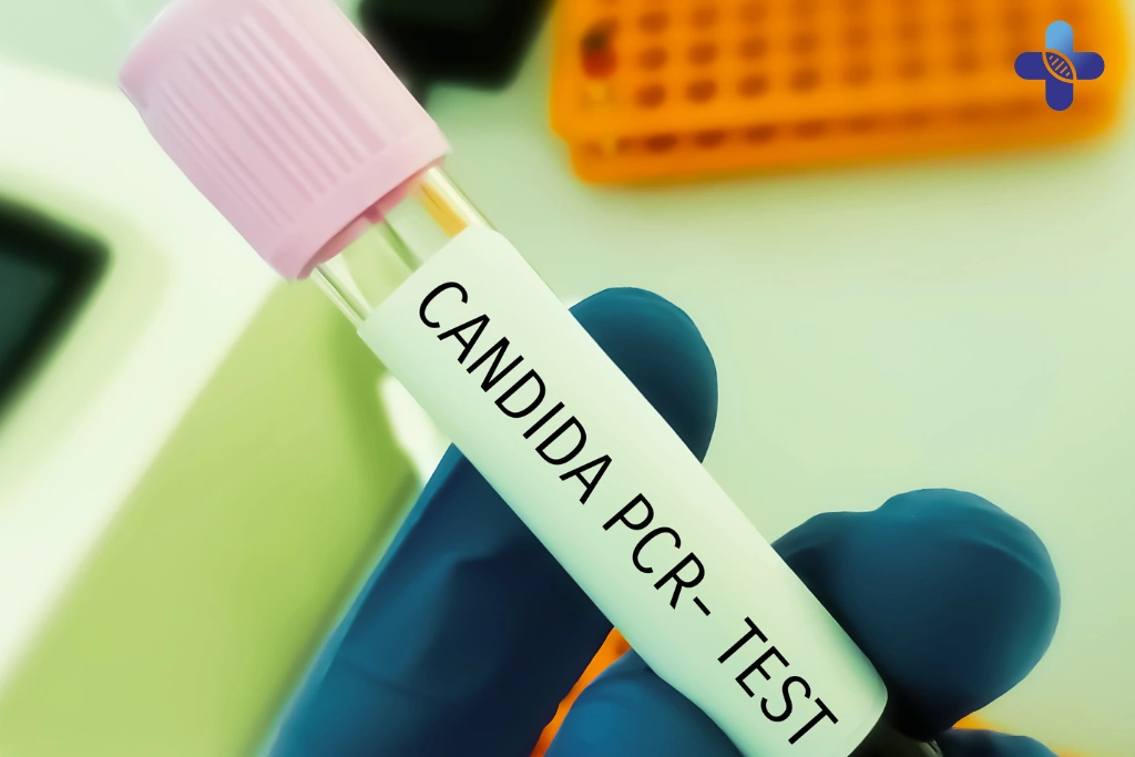 What Tests Are Available for Tourists in Bali
