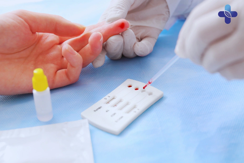 What’s Included in the Basic STD Test Package in Bali