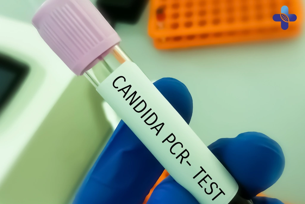 What’s Included in the Medium STD Test Package