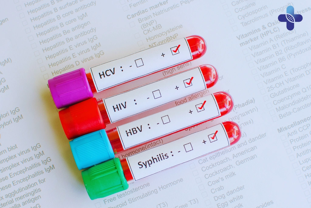 When Should You Get Tested