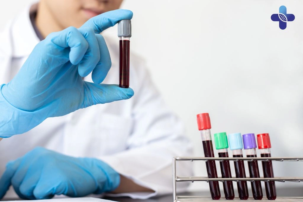 Where to Get Discreet STD Testing in Bali