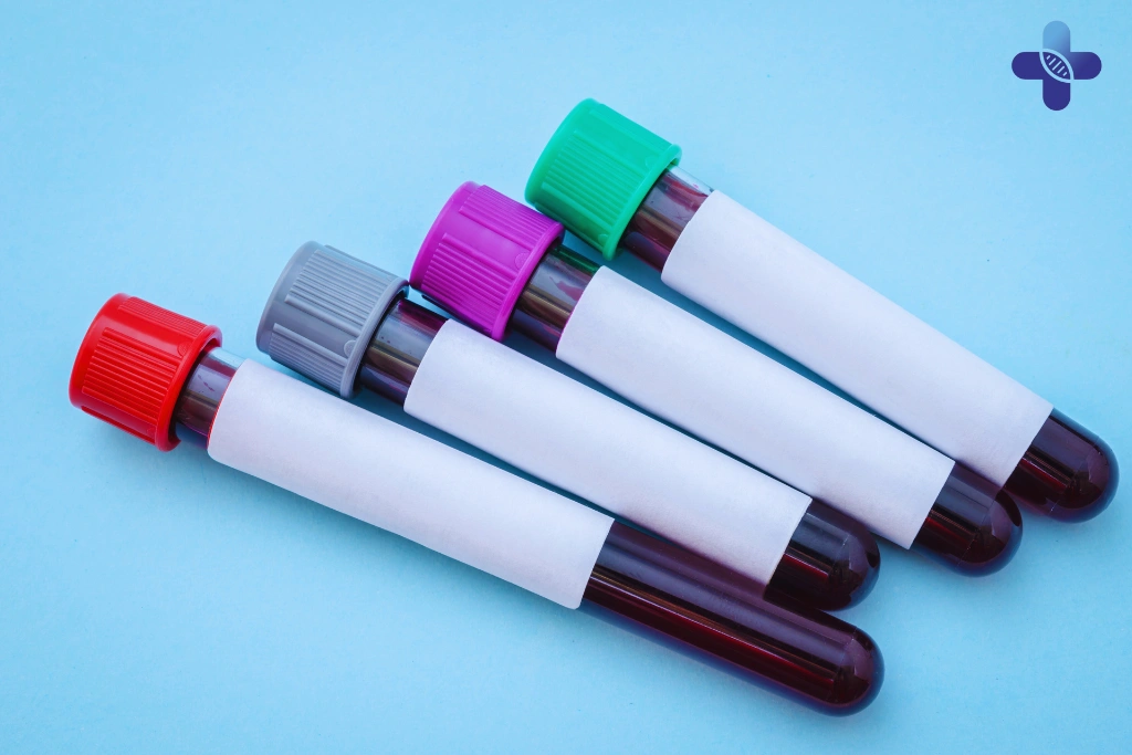 Where to Get Reliable STD Testing in Bali