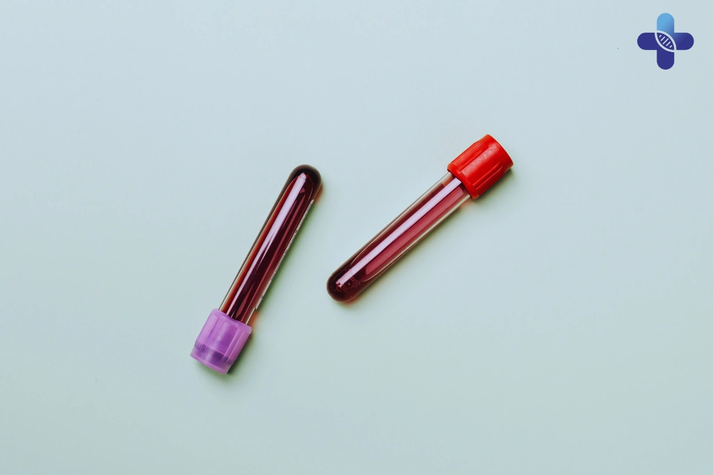 Where to Go for STD Testing in Bali Together