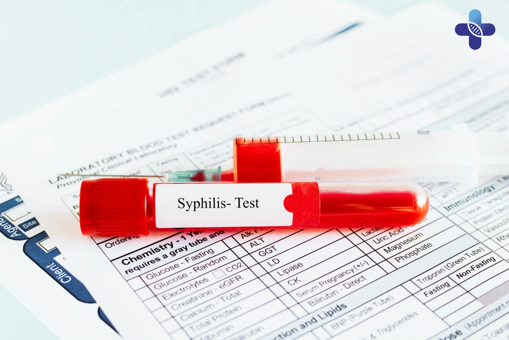 Why Early Testing in Bali Matters