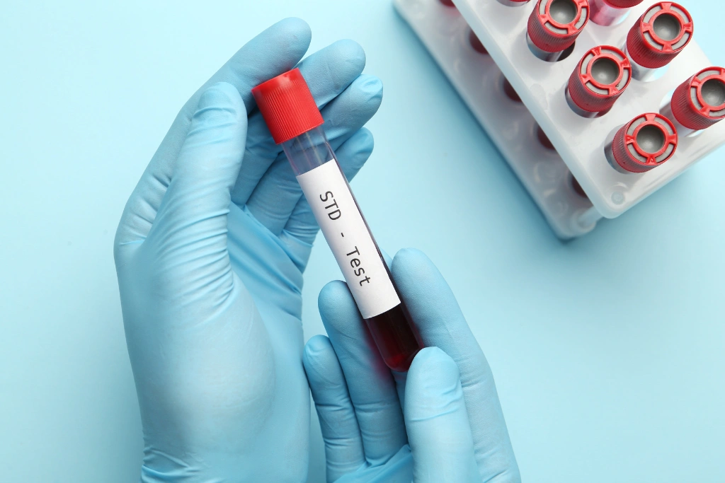 Can I Mix and Match STD Tests in Bali_ Here’s What You Need to Know