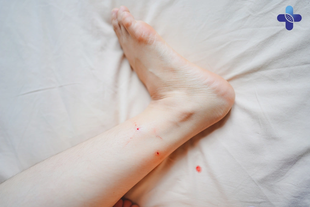 Early Symptoms of Rabies in Humans Why Immediate Treatment is Non-Negotiable