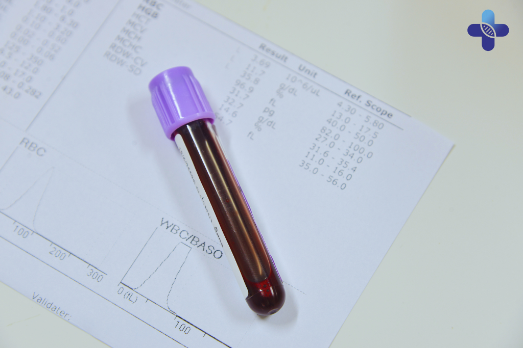 How to Choose the Right STD Package in Bali Based on Your Risk Factors