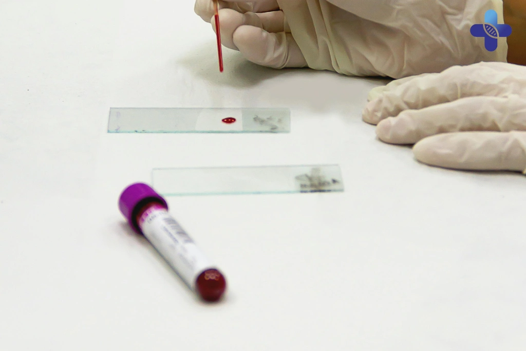 Key Elements of a Trusted STD Testing Service in Bali