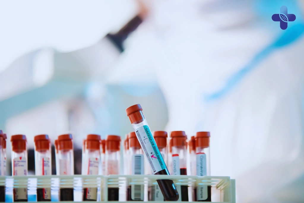 Premium STD Test Bali_ Who Needs It and Why