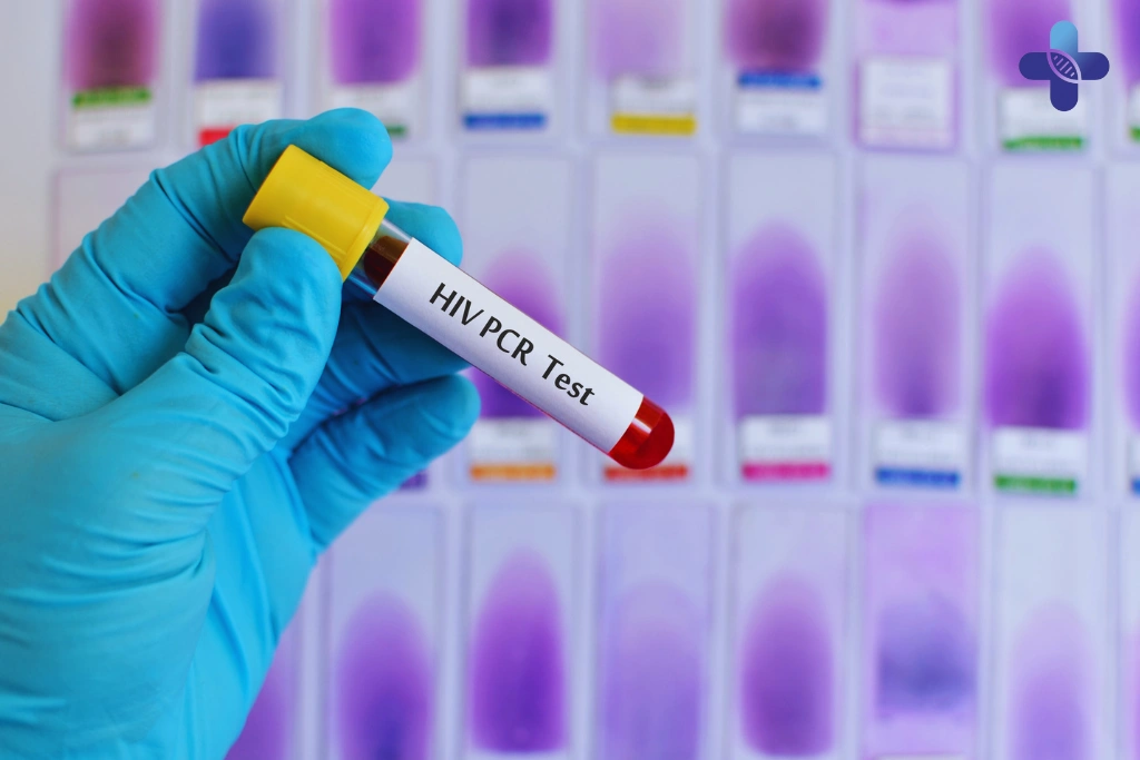 STD PCR Test in Bali_ Why Accuracy Matters in Sexual Health Screening