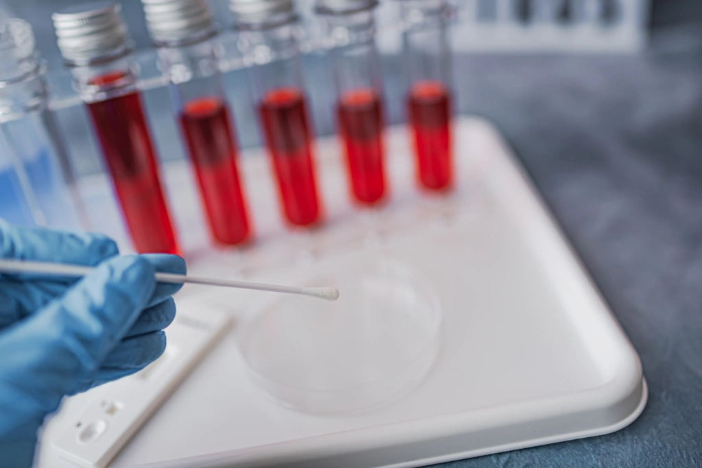 STD PCR vs. Rapid Test in Bali Which One Is Right for You
