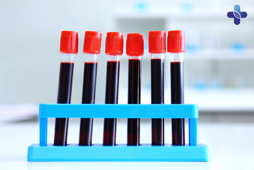 STD Packages at Life Everyouth Clinic That Use Each Method