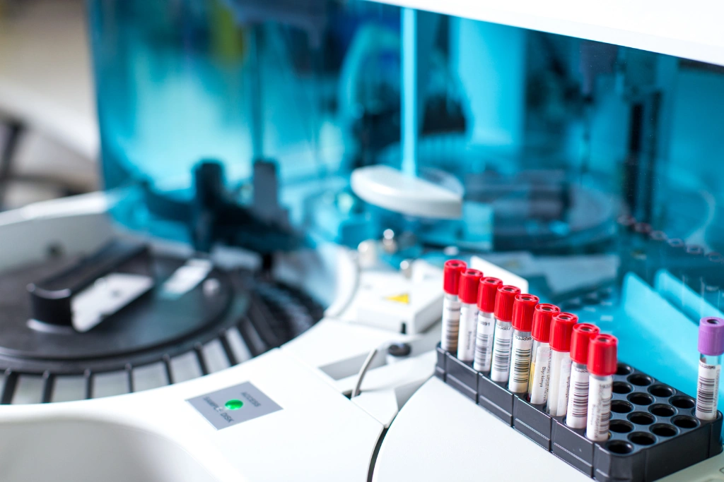 Should You Get Retested_ Understanding Follow-Up STD Screening Packages in Bali