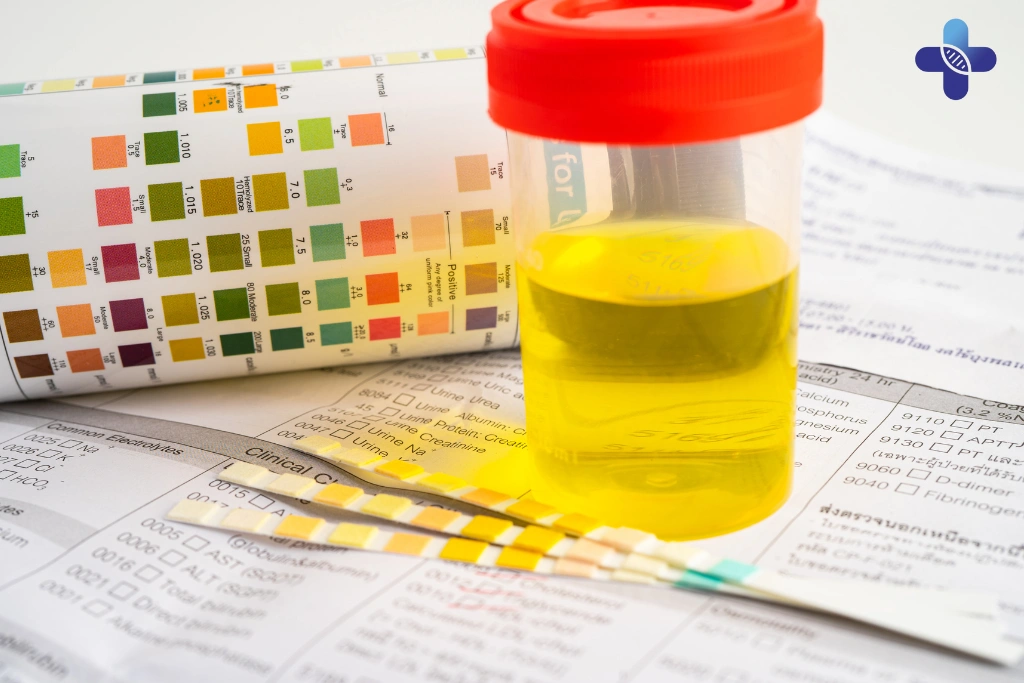 Urinalysis in STD Screening