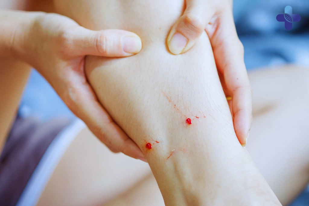 Why You Cannot _Wait and See_ for Symptoms