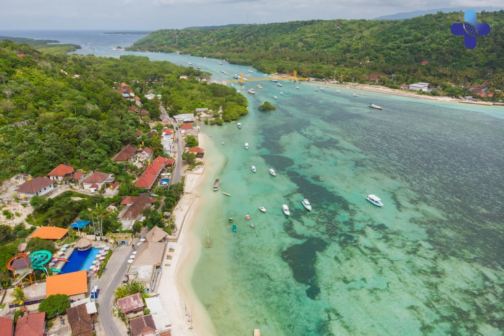Conclusion Fever and Night Sweats in Bali_ What It Means (2025)